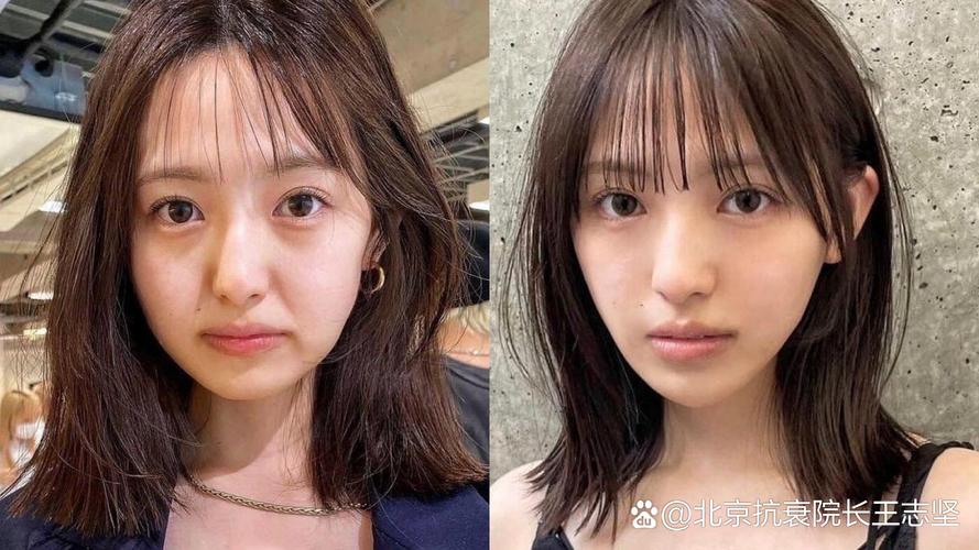 神经电生理检查是什么 神经电生理检查是什么